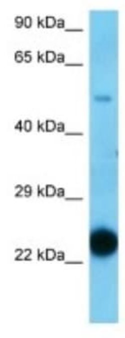 C5orf30 Rabbit anti-Mouse, Polyclonal, Novus Biologicals 100 &mu;g; Unconjugated:Antibodies,